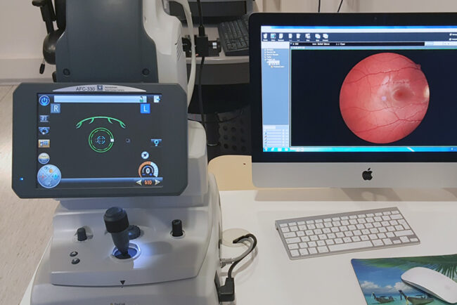 Netzhaut-Screening mit Funduskamera